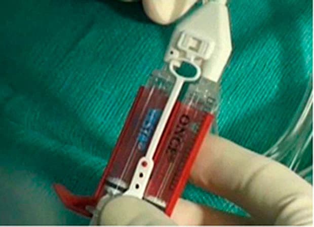 Et eksempel på en vævsklæber.