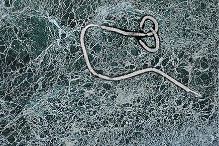 Mikroskopifoto af Ebolavirus.