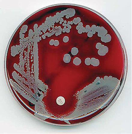 Staphylococcus aureus på blod­agar med intakt følsomhed for gentamicin (fra www.flickr.com/photos/estherase/ 34165928/).