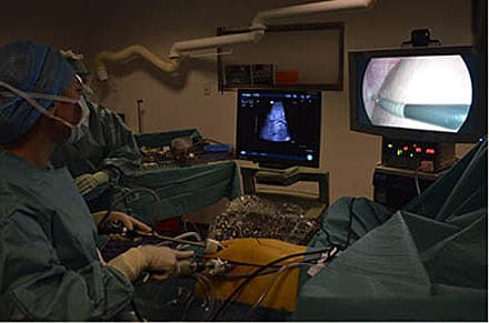 Laparoskopisk ultralydskanning