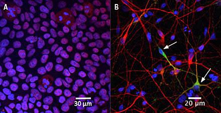 Forfatternes egne inducerede pluripotente stam (iPS)-celler før og efter neuronal uddifferentiering.