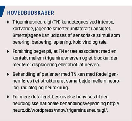 Diagnostik og behandling af trigeminusneuralgi | Ugeskriftet.dk