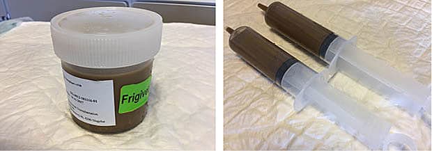 Optøet materiale til fækal mikrobiota-transplantation klar til brug. Fra donorfæcesbanken ved Sjællands Universitetshospital Køge. 