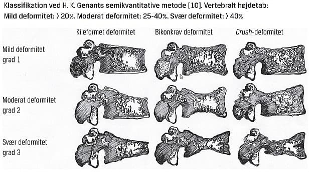 © Ugeskrift for Læger