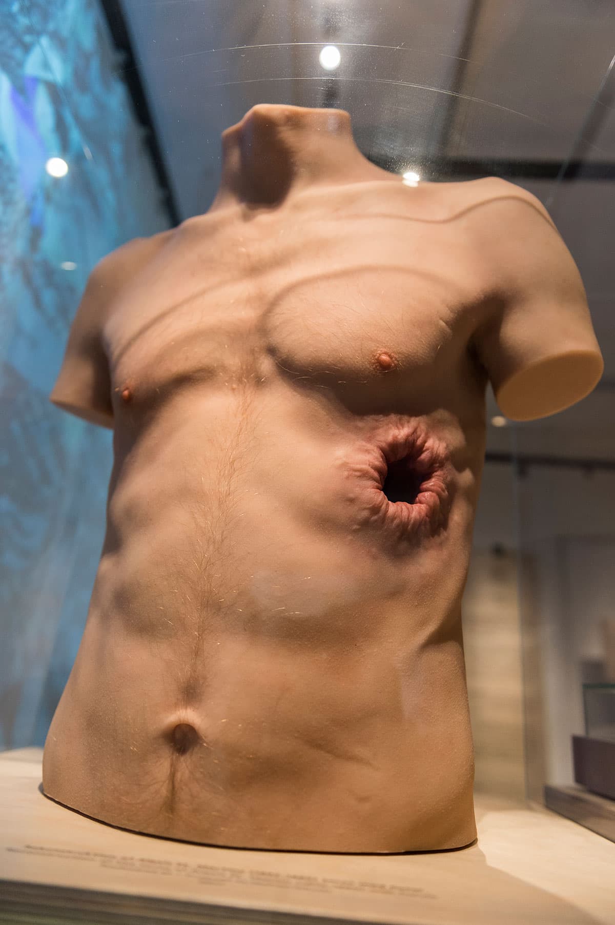 Torso med hud og hår af den skudramte jæger Alexis St. Martin skabt af Michael Schultz (Medicinsk Museion/foto: Morten Skovgaard).