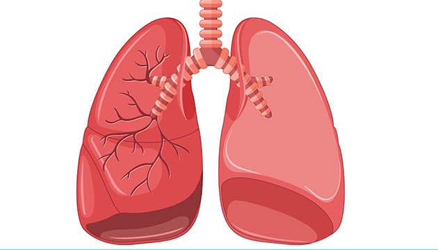 Illustration: Colourbox