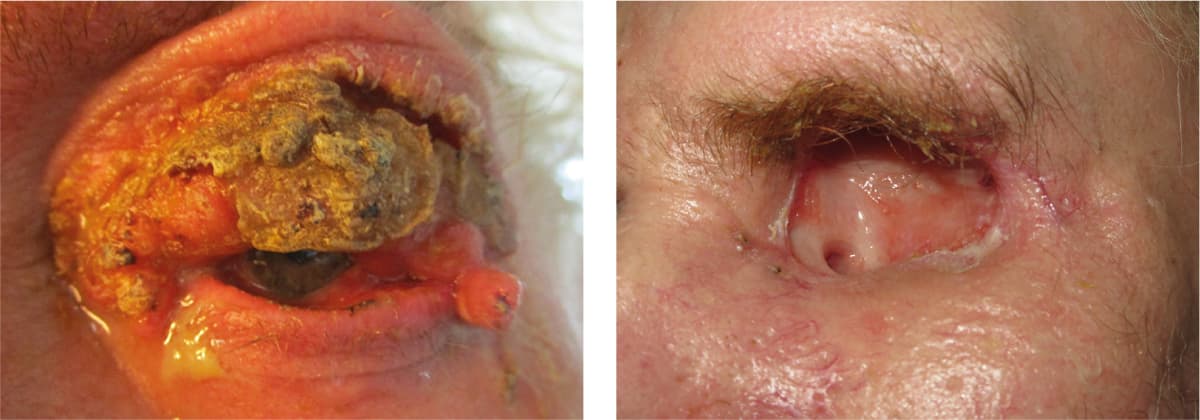 Fotos gengivet med tilladelse fra patienten.