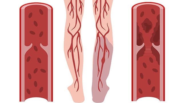 Illustration: Colourbox