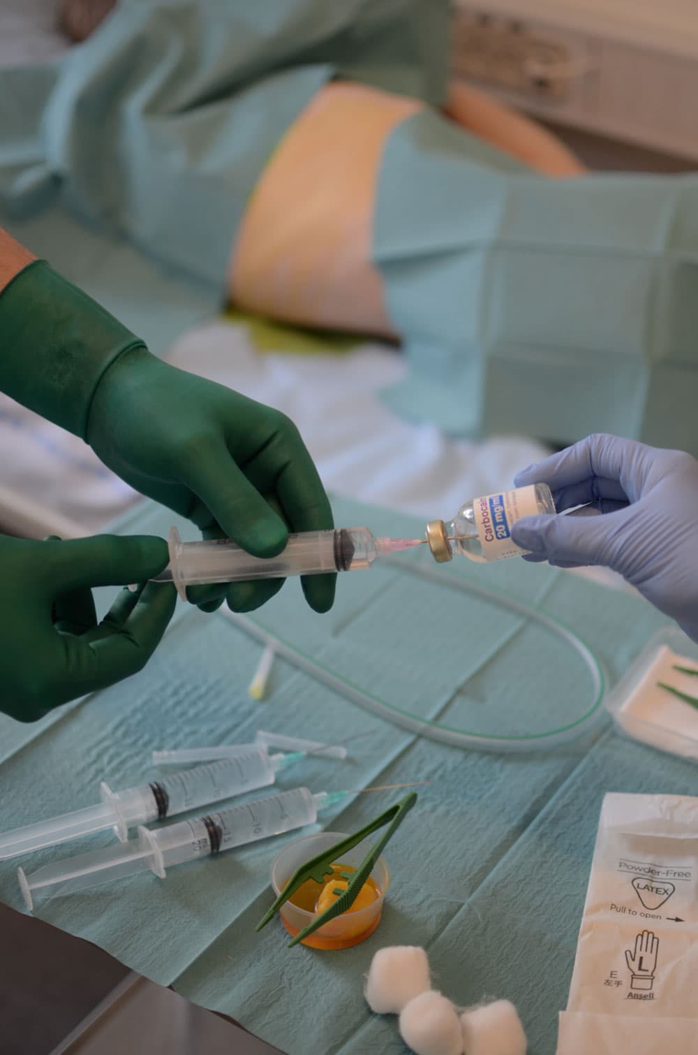 Pleuradrænanlæggelse. Interkostale injektioner med større mængder lokalanalgetika er hyppigt beskrevet som årsag til systemisk toksicitet.