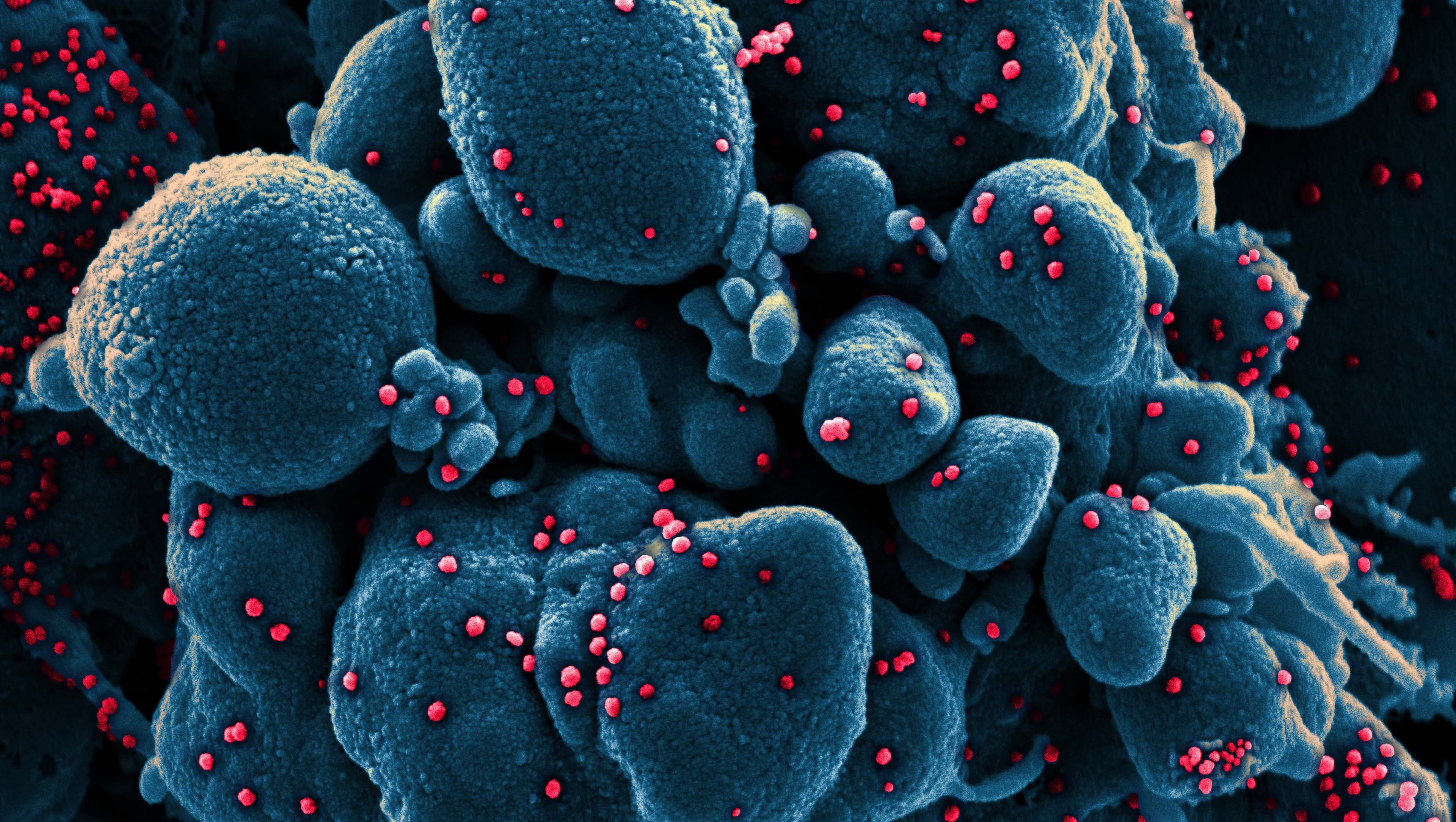 Illustration: NIAD-RML