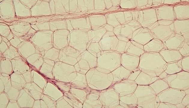 Foto: Reytan, Wikimedia