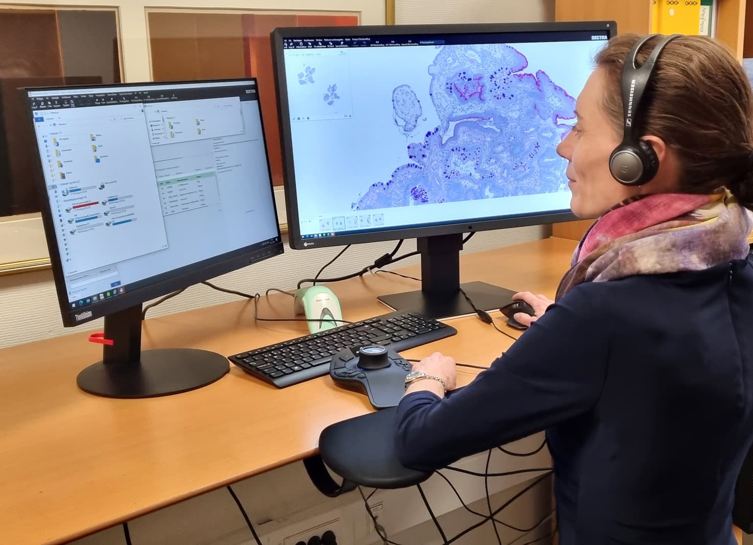 Patologens digitale arbejdsplads. En diagnostisk skærm til vurdering af de indskannede histologibilleder vha. image management-systemet, 3D-mus til billedmanøvrering, almindelig computerskærm til laboratorieinformationssystemet og elektronisk patientjournal, almindelig mus, almindeligt tastatur og standard-pc (ikke med på billedet).