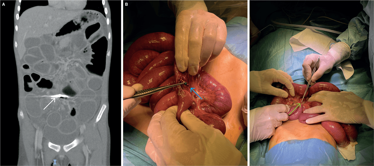 Fotos bringes med patientens forældres tilladelse.