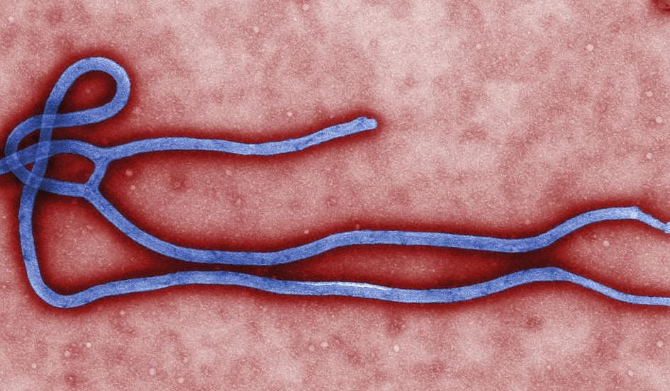 Ebola-virus kan i op til ni måneder findes hos mænd, der har overlevet sygdommen. Foto: Colourbox
