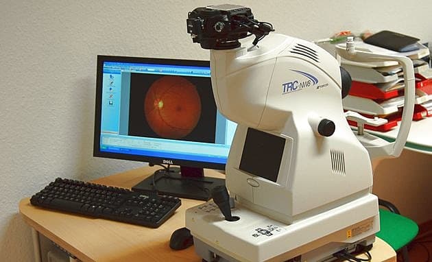 Fundus-kamera. Foto: Wikipedia