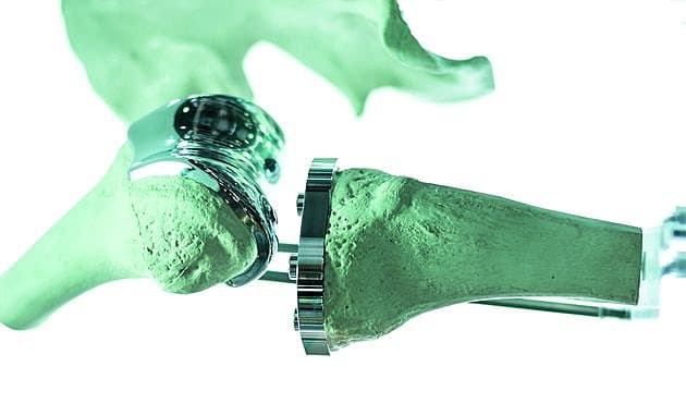 Knæ- og hofteprotese fremstilled v.hj.a. CAD og 3D-print. Foto: Bigstock.