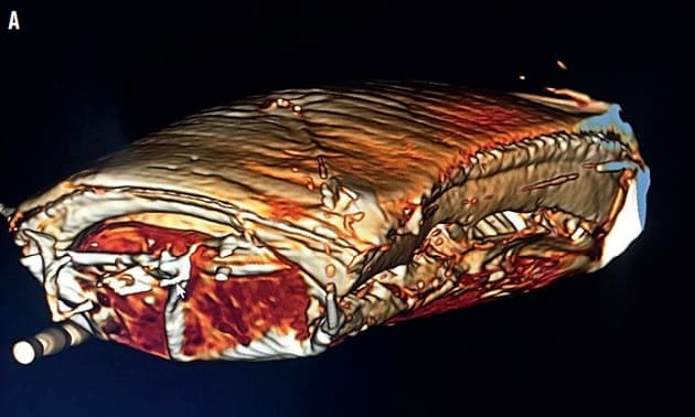 © Ugeskrift for Læger