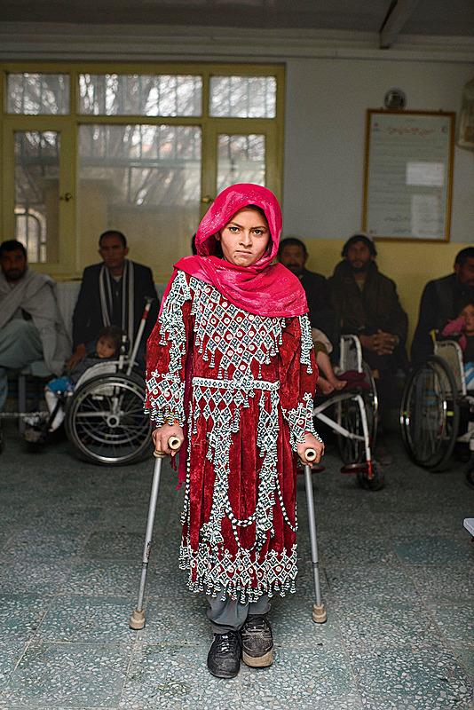 Hver tredje måned rejser 8-årige Zarsanga 3 timer i bus fra Ghazni til ICRC ortopædiske centre i Kabul, hvor lægerne arbejder på at få hende til at gå igen. Hun mistede sin fod, da sprængstykker fra en raket ramte hendes venstre ben i 2016.