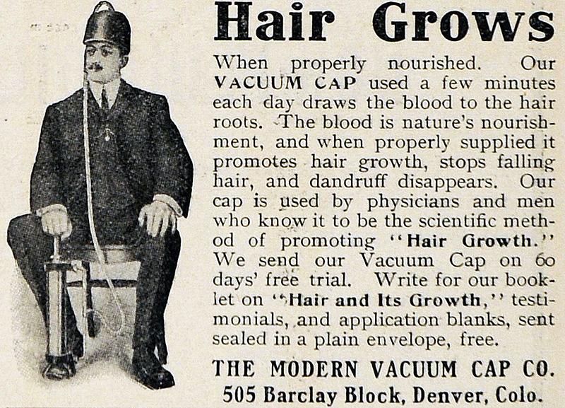 Der har alle dage været penge at tjene på løfter om at "kurere" hårtab. Og denne vakuum-anordning var tilmed "videnskabelig".