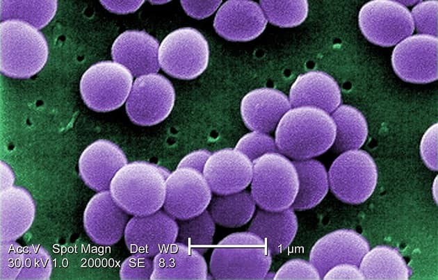 Staphylococcus aureus. Kilde: https://phil.cdc.gov/details.aspx?pid=11157 /