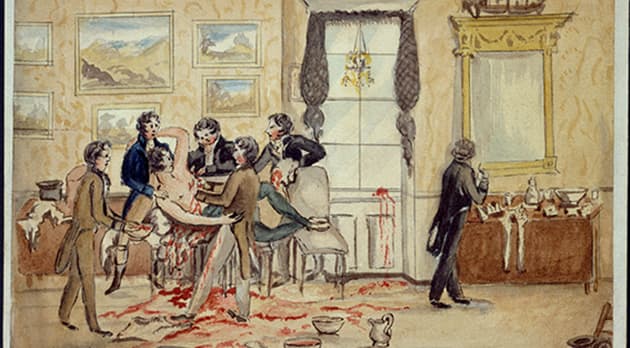 Uden bedøvelse. Kirurger fjerner malign svulst fra en mands venstre bryst og armhule i en daglligstue i Dublin i 1817. Ill.: The Wellcome Collection.