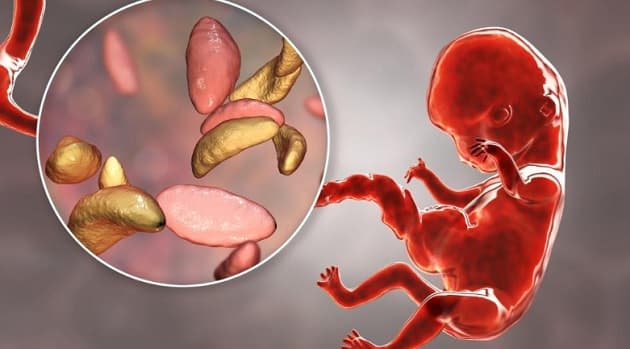 Transplacental smitte af foster med Toxoplasma gondii.