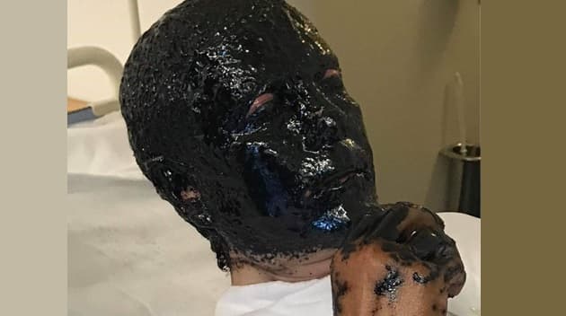 Patienten i sygehistorien ved ankomst til skadestuen. Gengivet med tilladelse.