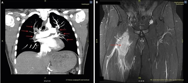 Ugeskr Læger 2022;184:V08210662