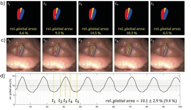 Ugeskr Læger 2022;184:V02210146