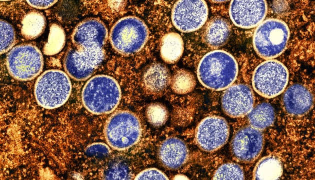 Abekopper (Foto: NIAID)