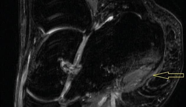 Ugeskr Læger 2022;184:V05220303