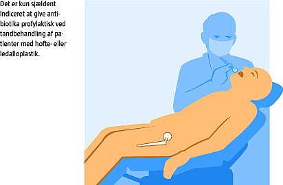 Antibiotikumprofylakse ved tandbehandling hos patienter med eller knæledsalloplastik er sjældent nødvendig Ugeskriftet.dk