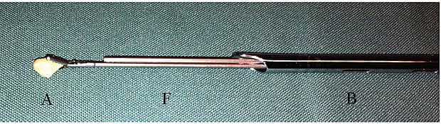 An optical forceps (F) is passed through the rigid bronchoscope (B) to firmly grab a piece of almond (A). The forceps and the rigid bronchoscope can then be removed simultaneously from the respiratory tract whereby the foreign body is removed.