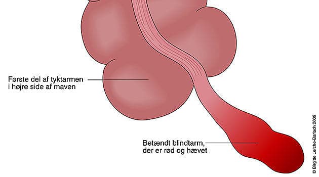Illustration: Birgitte Lerche-Berlach