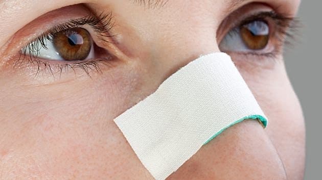 En 40-årig kvinde fik i 2016 foretaget næsekorrektion og abdominal fedtsugning i Mellemøsten. Efterforløbet blev dog kompliceret.