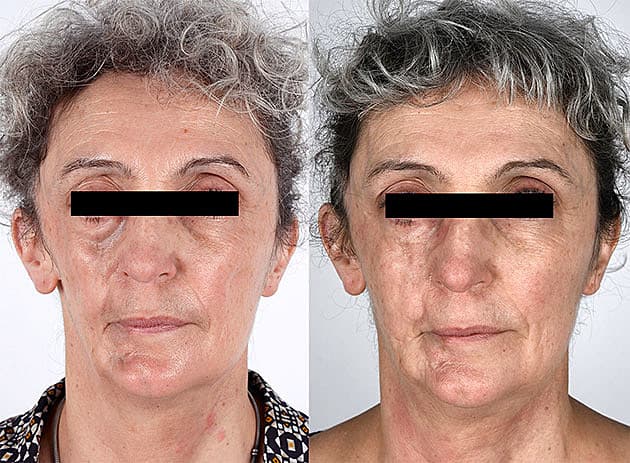 Klinisk foto: Tina Rasmussen