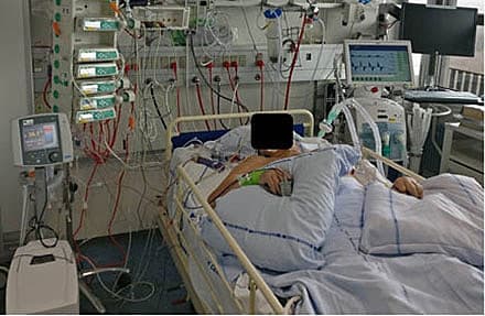 En komatøs patient kort tid efter genoplivning efter hjertestop uden for hospital.