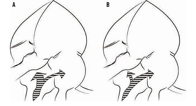 © Ugeskrift for Læger