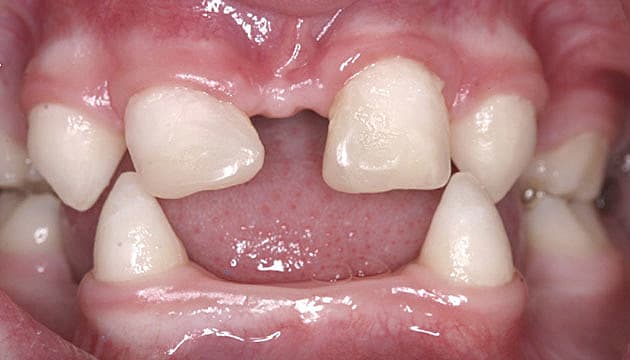 Foto: Wikimedia Commons