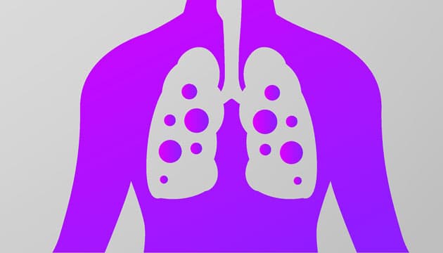 Illustration: Colourbox