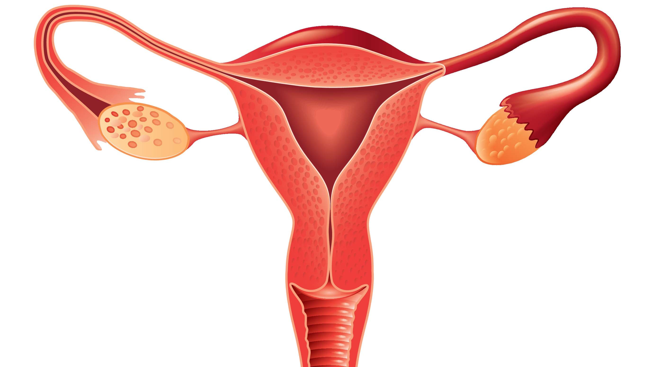 Illustration: Colourbox