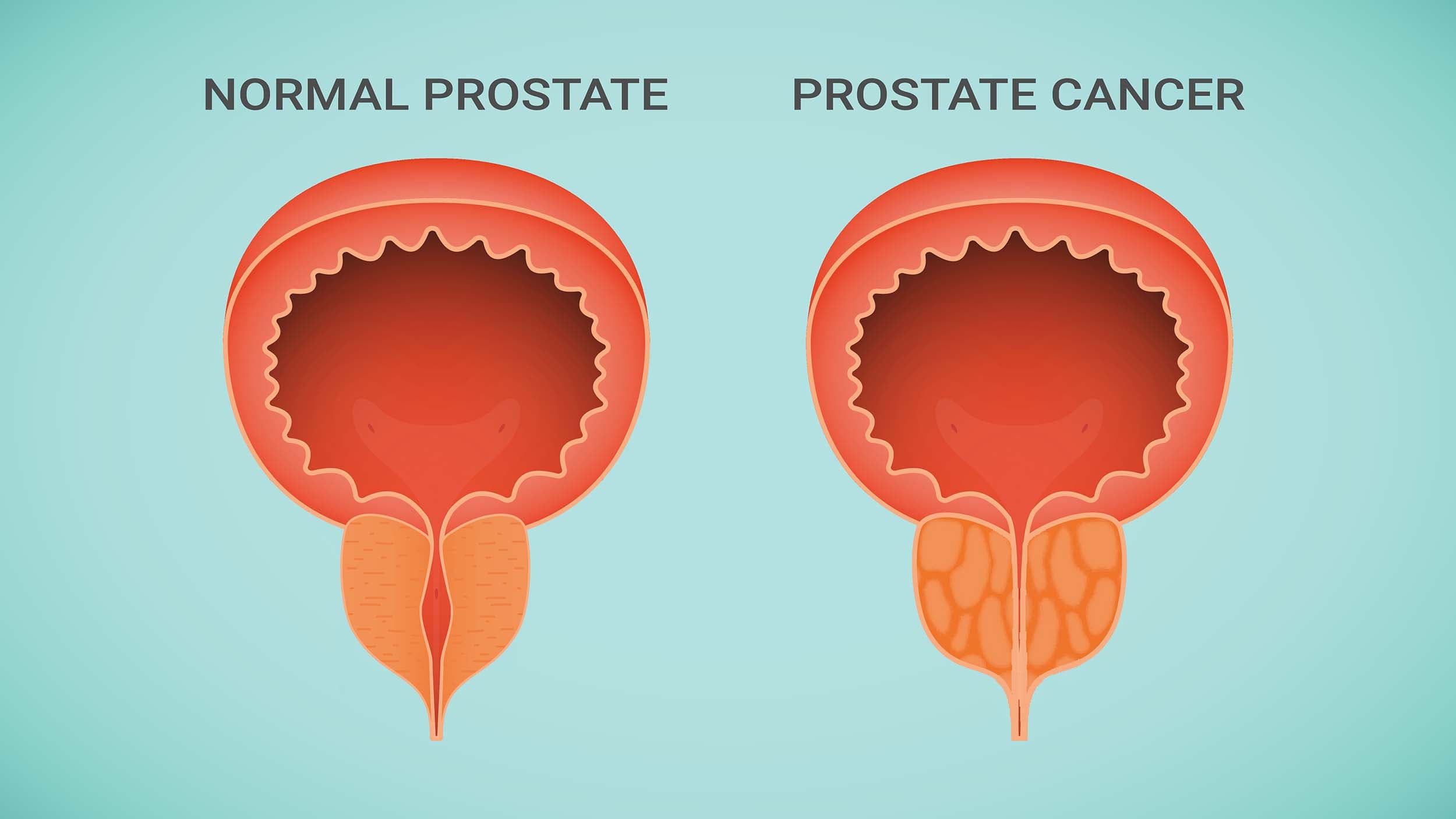 Illustration: Colourbox