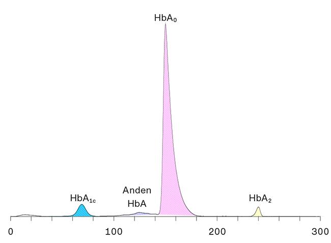 Resultatet fra en bestemmelse af den relative mængde af glykeret hæmoglobin (HbA1c) med hæmoglobinfraktionering vha. kapillærelektroferese. HbA1c-svaret angives som arealet af den lyseblå top divideret med total hæmoglobin A (summen af arealerne af den lilla, pink og gule top). HbA1c er her i normal­området.
