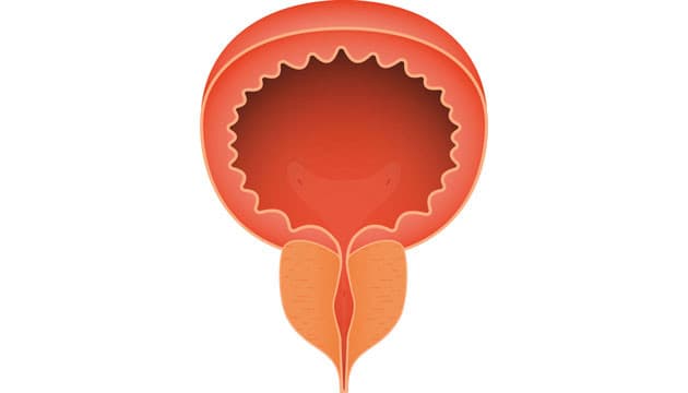 Illustration: Colourbox