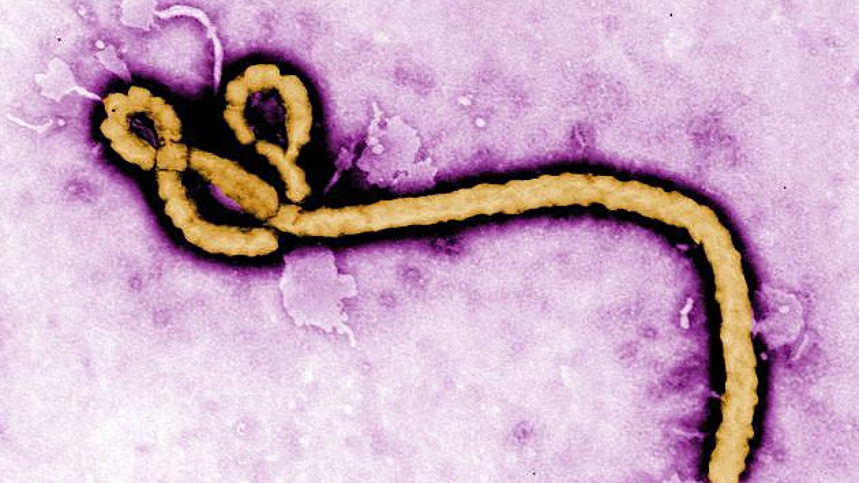 Ebola virus virion under elektronmikroskop. Foto: CDC