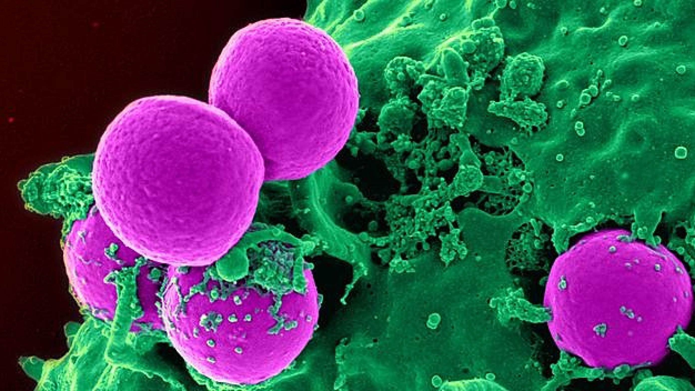 MRSA - Multiresistent Stafylococcus aureus. Foto: Colourbox