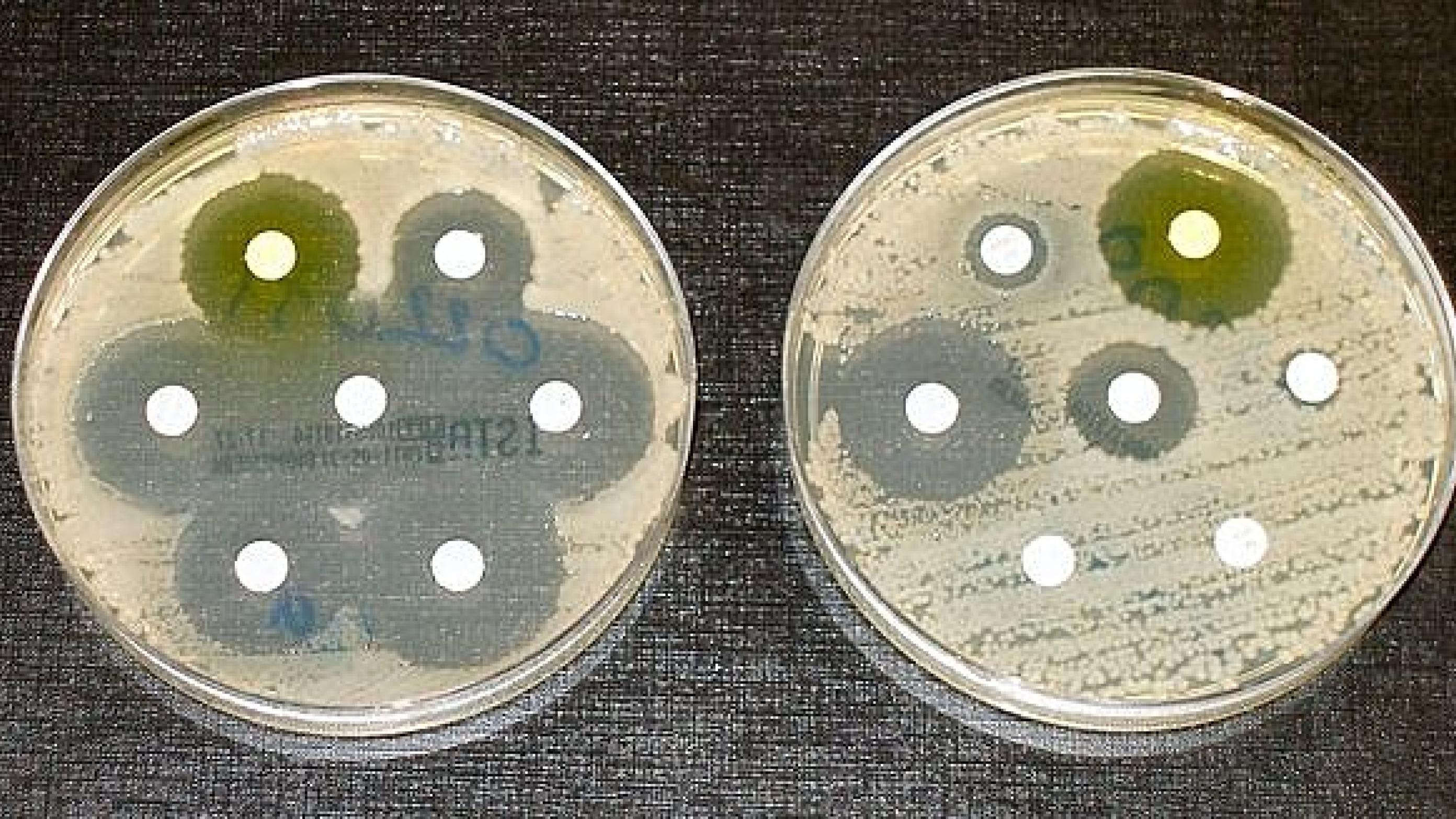 Bakterier i petriskåle med hvide antibiotika-skiver. Tv: klare ringe viser, at bakterierne ikke er vokset; de er altså ikke resistente. Th: Kun tre af testens antibiotika virker fuldtud.