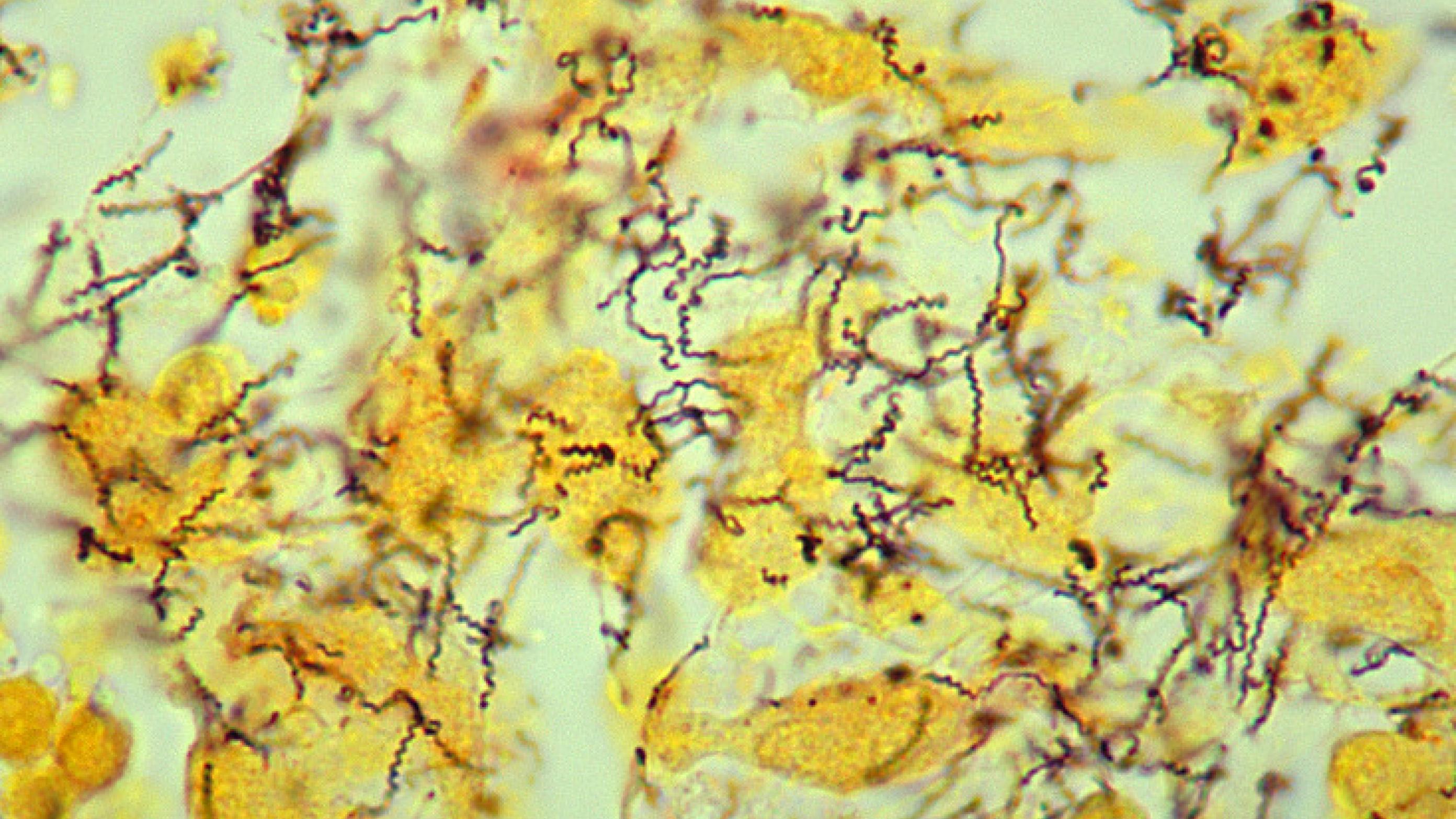 Treponema pallidum - syfilisbacillen. Foto: Wikimedia