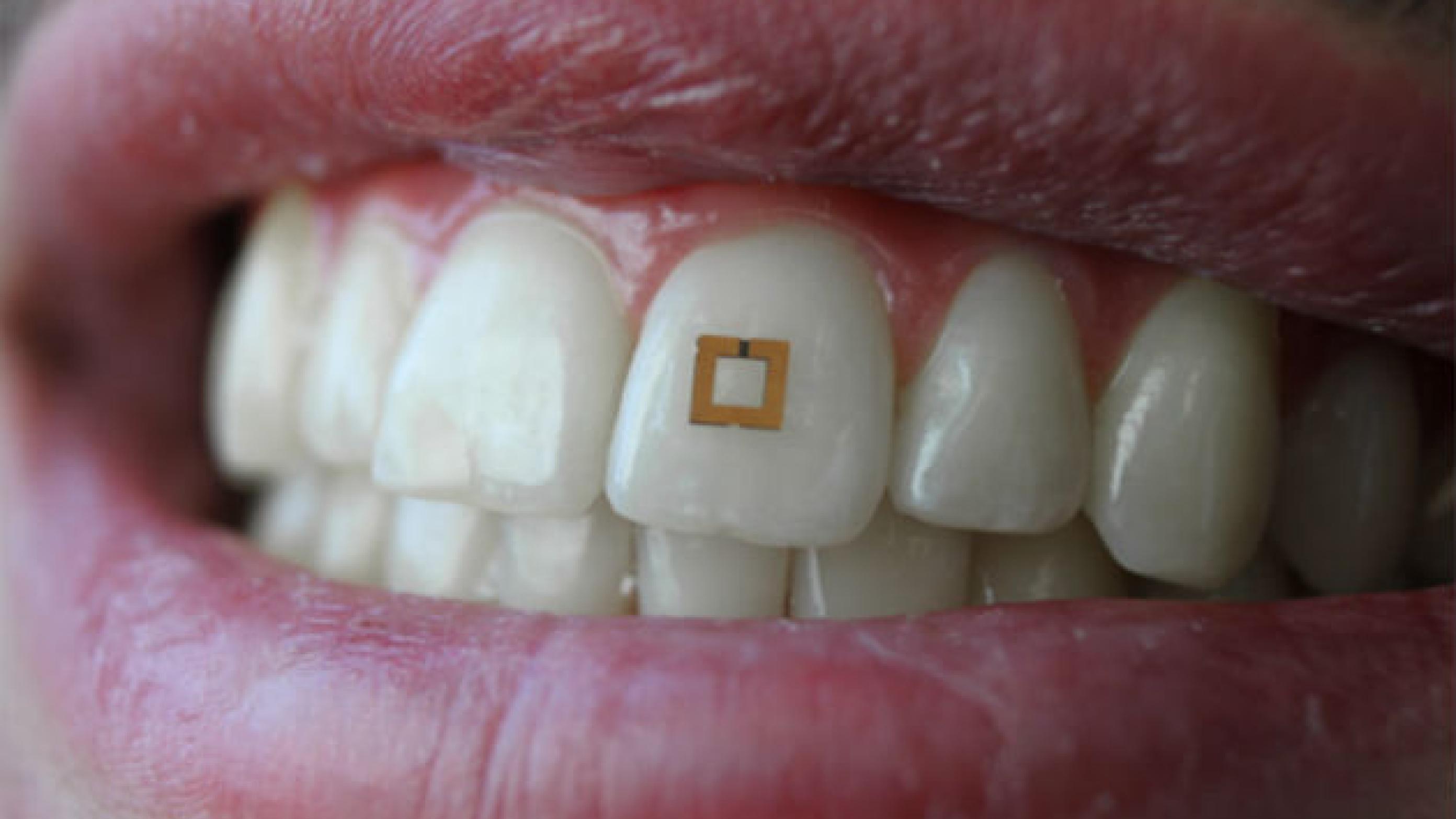 Amerikanske forskere fra Tufts University er ved at udvikle sensorer, som kan sidde på tænderne og sladre om, hvad vi spiser og drikker – og om sundhedstilstanden i munden. Foto: SilkLab/Tufts University