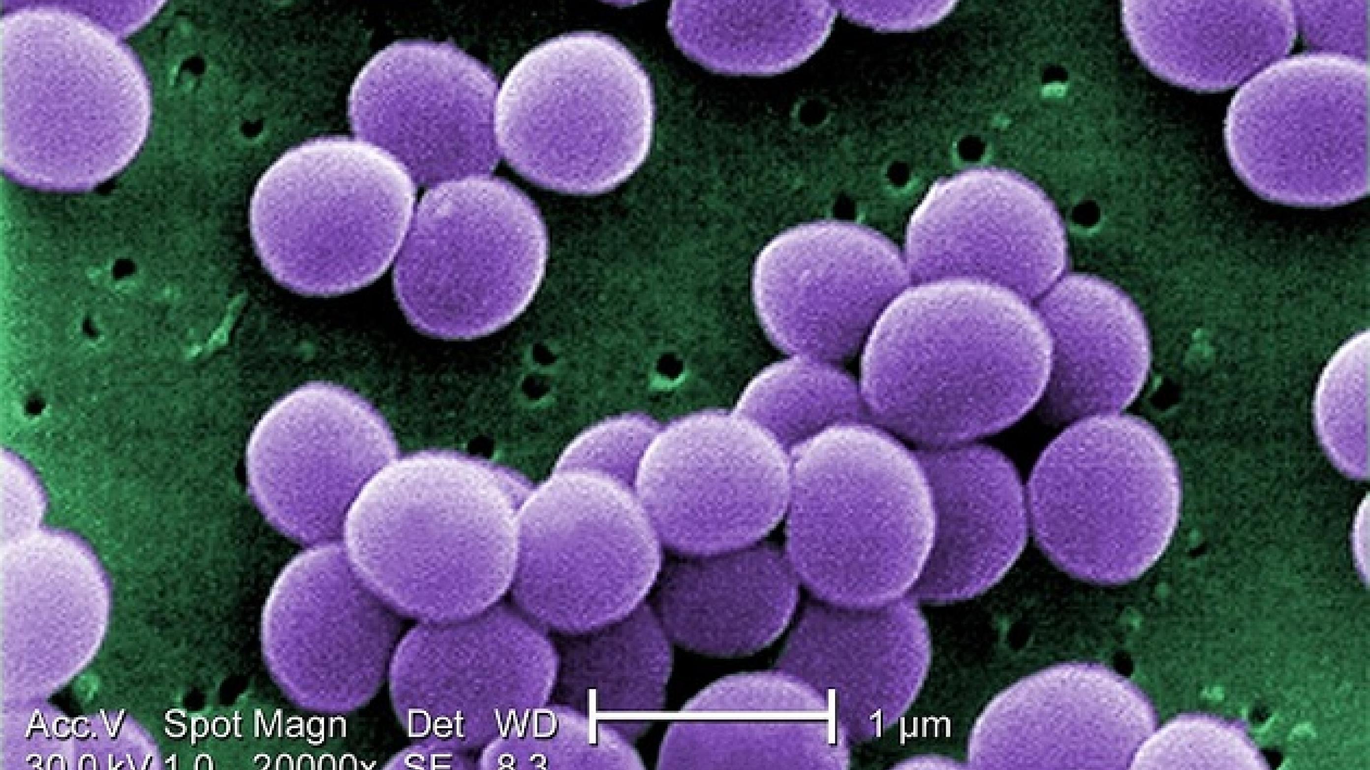 Staphylococcus aureus. Kilde: https://phil.cdc.gov/details.aspx?pid=11157 / 